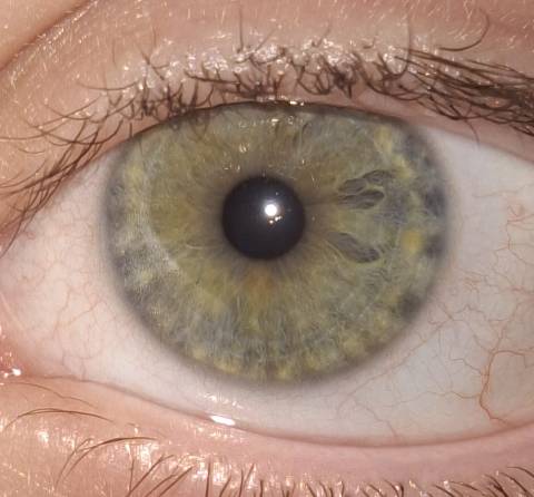 Kika's eye